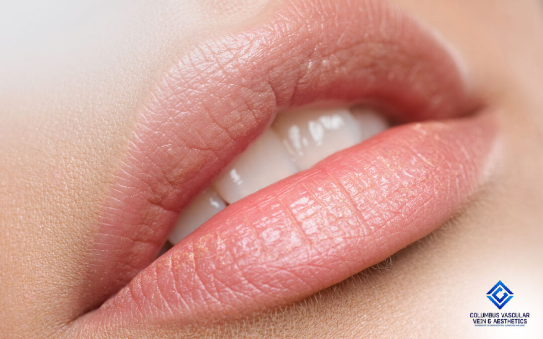 Lip Flip vs. Lip Filler: What’s the difference?