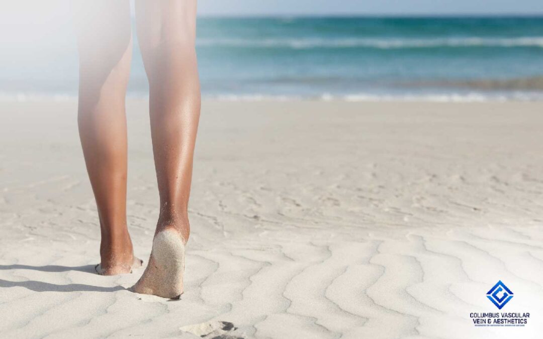 Summer Tips for Healthy Veins